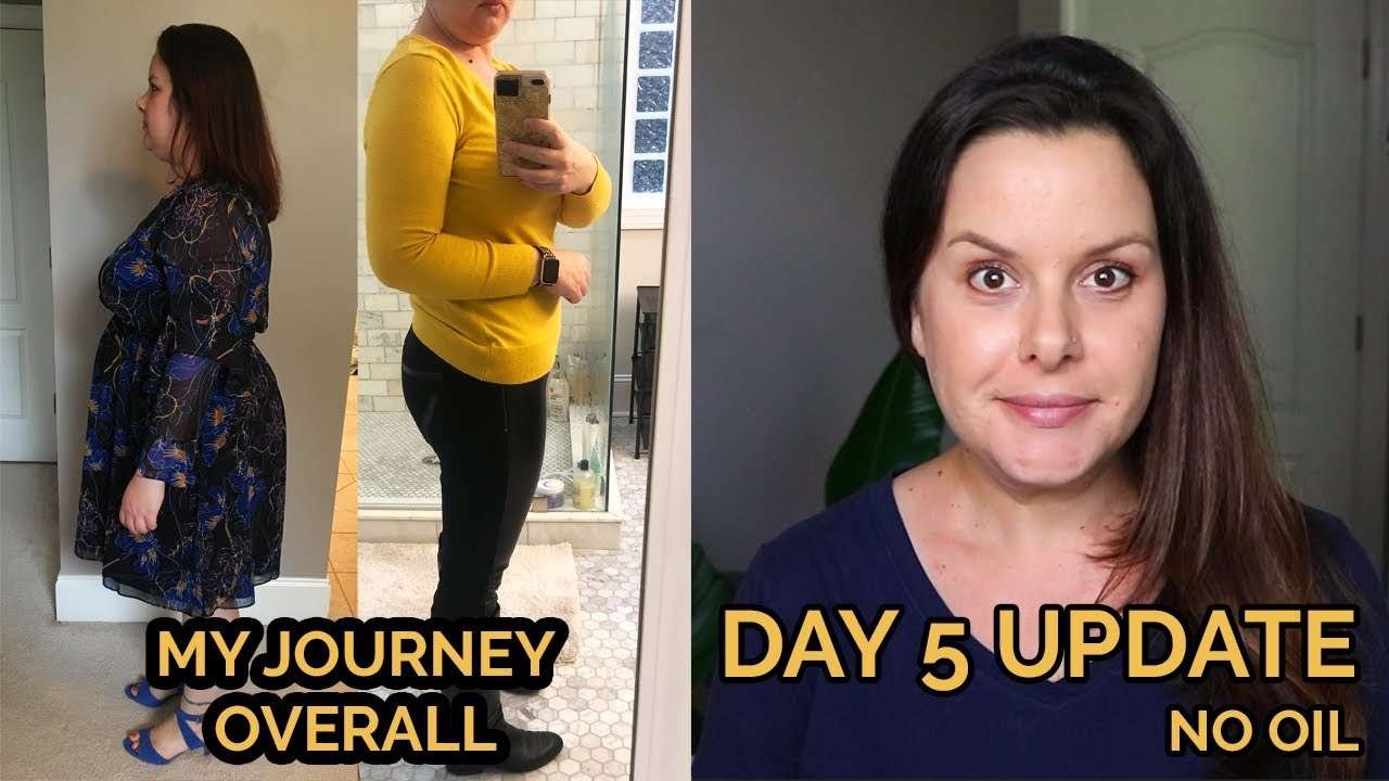 McDougall Maximum Weight Loss & My Journey Update (High Liver Enzymes)